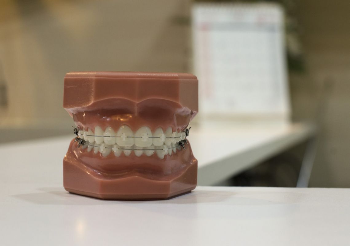 Brug Tandprotetikeren hvis tænderne ikke sidder ordentligt i